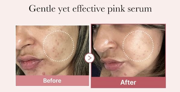 Medicube PDRN pink peptide serum