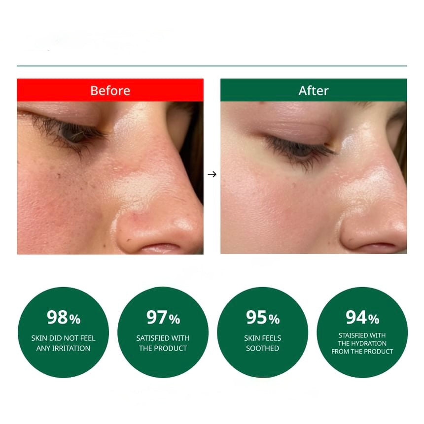 Dr.G  R.E.D Blemish Cica Soothing Cream