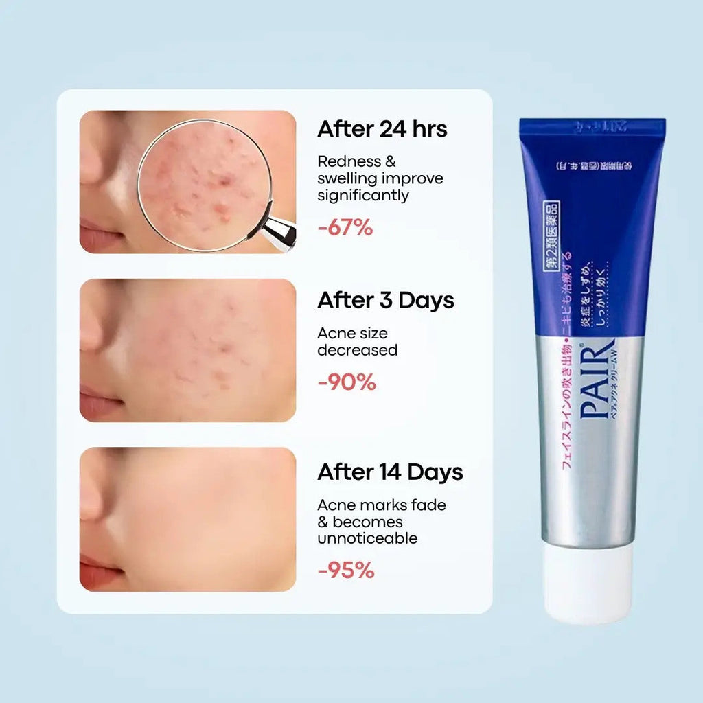 LION  Pair Acne Cream